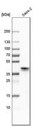 Distal-Less Homeobox 5 antibody, HPA005670, Atlas Antibodies, Western Blot image 