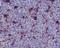 MER Proto-Oncogene, Tyrosine Kinase antibody, M00489, Boster Biological Technology, Immunohistochemistry frozen image 