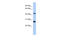 Synaptotagmin 9 antibody, ARP53322_P050, Aviva Systems Biology, Western Blot image 