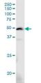 Armadillo Repeat Containing X-Linked 3 antibody, H00051566-M01, Novus Biologicals, Western Blot image 