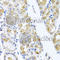 Transmembrane Protein 43 antibody, A8509, ABclonal Technology, Immunohistochemistry paraffin image 