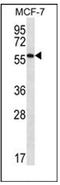 Serum Amyloid A Like 1 antibody, AP53787PU-N, Origene, Western Blot image 