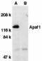 Apoptotic Peptidase Activating Factor 1 antibody, 2015, QED Bioscience, Western Blot image 