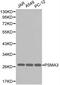 Proteasome Subunit Alpha 3 antibody, PA5-76004, Invitrogen Antibodies, Western Blot image 