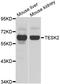 Testis Associated Actin Remodelling Kinase 2 antibody, LS-C349161, Lifespan Biosciences, Western Blot image 
