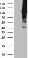 HECT Domain And Ankyrin Repeat Containing E3 Ubiquitin Protein Ligase 1 antibody, TA810060, Origene, Western Blot image 