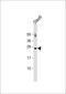 PTTG1 Regulator Of Sister Chromatid Separation, Securin antibody, 62-848, ProSci, Western Blot image 