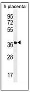 Olfactory Receptor Family 5 Subfamily AS Member 1 antibody, AP53085PU-N, Origene, Western Blot image 