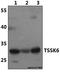 Testis Specific Serine Kinase 6 antibody, A11136, Boster Biological Technology, Western Blot image 