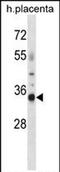 Olfactory Receptor Family 4 Subfamily K Member 13 antibody, PA5-71940, Invitrogen Antibodies, Western Blot image 