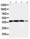 Arginase 2 antibody, PA1805, Boster Biological Technology, Western Blot image 