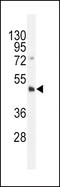 DNA Methyltransferase 3 Like antibody, LS-C96556, Lifespan Biosciences, Western Blot image 