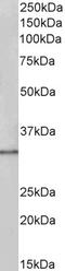 Tetraspanin 14 antibody, 43-172, ProSci, Western Blot image 