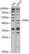 Inositol Hexakisphosphate Kinase 2 antibody, 22-771, ProSci, Western Blot image 