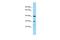 Suprabasin antibody, A12244, Boster Biological Technology, Western Blot image 