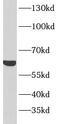 5 -AMP-activated protein kinase catalytic subunit alpha-2 antibody, FNab00376, FineTest, Western Blot image 