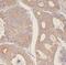 F-box/WD repeat-containing protein 2 antibody, FNab03054, FineTest, Immunohistochemistry paraffin image 