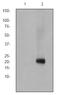 CD247 Molecule antibody, ab68235, Abcam, Western Blot image 