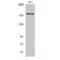 Erb-B2 Receptor Tyrosine Kinase 3 antibody, LS-C383411, Lifespan Biosciences, Western Blot image 