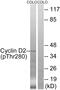 Cyclin D2 antibody, PA5-40166, Invitrogen Antibodies, Western Blot image 