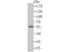 Syntrophin Alpha 1 antibody, A05370, Boster Biological Technology, Western Blot image 