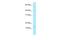 Prefoldin Subunit 4 antibody, A11965, Boster Biological Technology, Western Blot image 