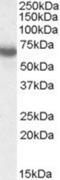 IKAROS Family Zinc Finger 1 antibody, NBP1-00125, Novus Biologicals, Western Blot image 
