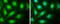 SMAD Family Member 4 antibody, GTX112980, GeneTex, Immunofluorescence image 