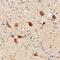 ALK Receptor Tyrosine Kinase antibody, AF4210, R&D Systems, Immunohistochemistry paraffin image 