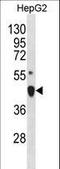 LIM Homeobox 4 antibody, LS-C157864, Lifespan Biosciences, Western Blot image 