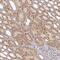 Interleukin 1 Receptor Associated Kinase 2 antibody, NBP2-38629, Novus Biologicals, Immunohistochemistry frozen image 