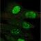 Telomerase Reverse Transcriptase antibody, NBP2-56116, Novus Biologicals, Immunofluorescence image 