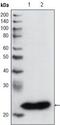 Glutathione S-Transferase Pi 1 antibody, MA5-15309, Invitrogen Antibodies, Western Blot image 