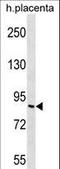 Adhesion G Protein-Coupled Receptor F2 antibody, LS-C166588, Lifespan Biosciences, Western Blot image 