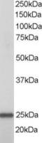 RAN, Member RAS Oncogene Family antibody, LS-B8294, Lifespan Biosciences, Western Blot image 