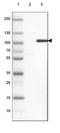 Kinesin Family Member 9 antibody, NBP1-82773, Novus Biologicals, Western Blot image 