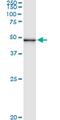 Pseudouridine Synthase 1 antibody, MA5-24492, Invitrogen Antibodies, Immunoprecipitation image 