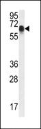 Coiled-Coil Domain Containing 102A antibody, PA5-48164, Invitrogen Antibodies, Western Blot image 