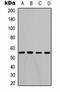 Lactate Dehydrogenase D antibody, orb334764, Biorbyt, Western Blot image 