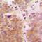 Mitogen-Activated Protein Kinase Kinase Kinase 7 antibody, orb256672, Biorbyt, Immunohistochemistry paraffin image 