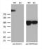 Microtubule Associated Serine/Threonine Kinase 2 antibody, M07003, Boster Biological Technology, Western Blot image 