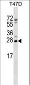 Zinc Finger Matrin-Type 2 antibody, LS-C160795, Lifespan Biosciences, Western Blot image 