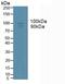 ADAM Metallopeptidase Domain 17 antibody, LS-C314251, Lifespan Biosciences, Western Blot image 