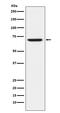 Gamma-Aminobutyric Acid Type A Receptor Alpha5 Subunit antibody, M04383-1, Boster Biological Technology, Western Blot image 
