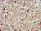 COP9 Signalosome Subunit 8 antibody, LS-C671988, Lifespan Biosciences, Immunohistochemistry paraffin image 