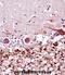 FA Complementation Group G antibody, abx028225, Abbexa, Immunohistochemistry frozen image 