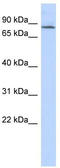 Amyloid Beta Precursor Protein Binding Family B Member 2 antibody, TA330953, Origene, Western Blot image 