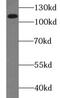 Roundabout Guidance Receptor 4 antibody, FNab07375, FineTest, Western Blot image 