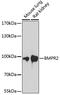 Bone Morphogenetic Protein Receptor Type 2 antibody, 16-748, ProSci, Western Blot image 