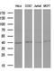 Fos Proto-Oncogene, AP-1 Transcription Factor Subunit antibody, LS-C798361, Lifespan Biosciences, Western Blot image 